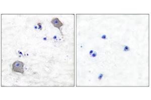 Immunohistochemical analysis of paraffin-embedded human brain tissue using Claudin 5 antibody (ABIN5976358). (Claudin 5 抗体  (C-Term))