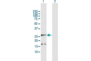 Western Blotting (WB) image for anti-B-Cell Receptor-Associated Protein 29 (BCAP29) (AA 1-241) antibody (ABIN527824)