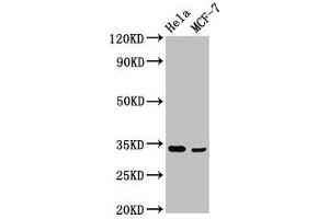 Western Blot Positive WB detected in: Hela whole cell lysate, MCF-7 whole cell lysate All lanes: NFKBID antibody at 3.