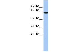 LEMD2 antibody used at 1 ug/ml to detect target protein. (LEMD2 抗体  (Middle Region))