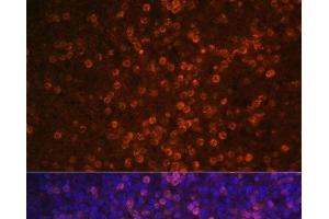 Immunofluorescence analysis of Human spleen using CR2 Polyclonal Antibody at dilution of 1:100 (40x lens).
