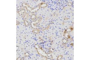 Immunohistochemistry (IHC) image for anti-ATG16 Autophagy Related 16-Like 1 (ATG16L1) (AA 90-300) antibody (ABIN1678769) (ATG16L1 抗体  (AA 90-300))