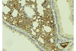 ABIN6277406 at 1/100 staining Mouse lung tissue by IHC-P.