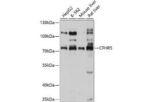 Western blot analysis of extracts of various cell lines, using CFHR5 antibody (ABIN6131938, ABIN6138459, ABIN6138460 and ABIN6214598) at 1:1000 dilution. (CFHR5 抗体  (AA 450-569))