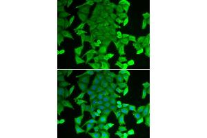 Immunofluorescence analysis of MCF-7 cell using RFFL antibody. (RFFL 抗体)