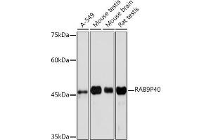 Western blot analysis of extracts of various cell lines, using RRP40 Rabbit mAb (ABIN7269816) at 1:1000 dilution.