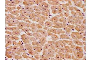 Immunohistochemistry (IHC) image for anti-Proteasome (Prosome, Macropain) 26S Subunit, Non-ATPase, 14 (PSMD14) (AA 264-283), (Regulatory Subunit 14) antibody (ABIN7139700)