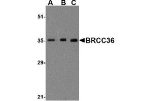 Western Blotting (WB) image for anti-BRCA1/BRCA2-Containing Complex, Subunit 3 (BRCC3) (N-Term) antibody (ABIN1031281) (BRCC3 抗体  (N-Term))