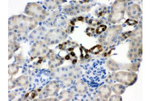 Anti- PGRMC1 Picoband antibody, IHC(P) IHC(P): Mouse Kidney Tissue (PGRMC1 抗体  (Middle Region))
