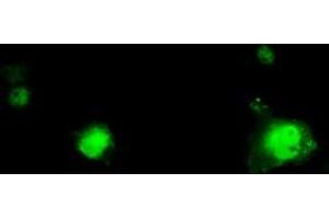 Image no. 1 for anti-Replication Protein A2, 32kDa (RPA2) antibody (ABIN1500739) (RPA2 抗体)