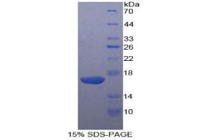 SDS-PAGE analysis of Human KLRB1 Protein. (CD161 蛋白)