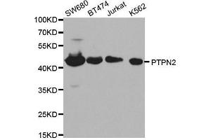 PTPN2 抗体  (AA 1-353)