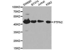 Western blot analysis of extracts of various cell lines, using PTPN2 antibody. (PTPN2 抗体  (AA 1-353))