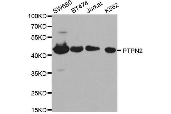 PTPN2 抗体  (AA 1-353)