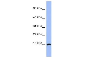 ACBD7 antibody used at 1 ug/ml to detect target protein. (ACBD7 抗体  (N-Term))