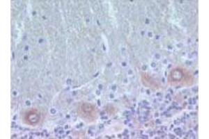 Rat brain zinc-fixed paraffin-embedded tissue (PKC delta 抗体  (AA 114-289))