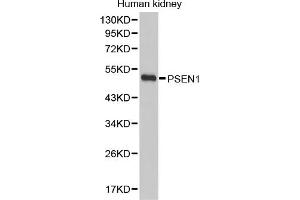 Western blot analysis of extracts of human kidney, using PSEN1 antibody (ABIN5971213). (Presenilin 1 抗体)