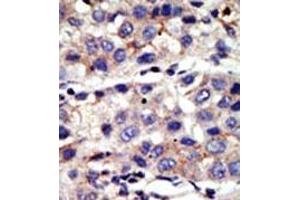 Image no. 2 for anti-Chromobox Homolog 4 (CBX4) (N-Term) antibody (ABIN357750) (CBX4 抗体  (N-Term))