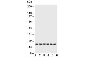 Western blot testing of Phospholamban antibody and Lane 1:  rat heart (Phospholamban 抗体  (N-Term))