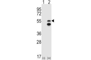 Western Blotting (WB) image for anti-Fyn-Related Kinase (FRK) antibody (ABIN3003444) (FRK 抗体)