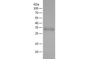 PPP1CB Protein (AA 298-324) (His-IF2DI Tag)