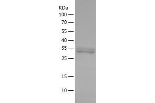 PPP1CB Protein (AA 298-324) (His-IF2DI Tag)