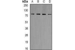 Western blot analysis of GlyRS expression in Jurkat (A), Raji (B), HT29 (C), mouse brain (D) whole cell lysates. (GlyRS 抗体)