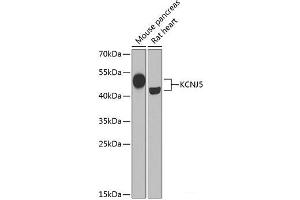 Western blot analysis of extracts of various cell lines using KCNJ5 Polyclonal Antibody at dilution of 1:1000. (KCNJ5 抗体)