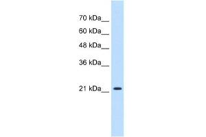 WB Suggested Anti-PGRMC1 Antibody Titration:  0. (PGRMC1 抗体  (N-Term))