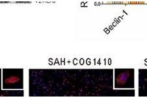 Western Blotting (WB) image for anti-Microtubule-Associated Protein 1 Light Chain 3 beta (MAP1LC3B) antibody (ABIN1385814)