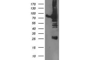 Western Blotting (WB) image for anti-Dipeptidyl-Peptidase 3 (DPP3) antibody (ABIN1497829) (DPP3 抗体)