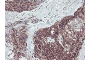 Image no. 1 for anti-Interferon Regulatory Factor 6 (IRF6) antibody (ABIN1498901) (IRF6 抗体)