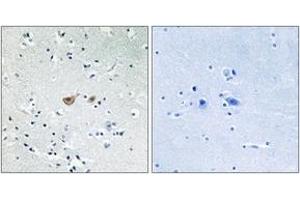 Immunohistochemistry analysis of paraffin-embedded human brain tissue, using FKHR (Ab-256) Antibody. (FOXO1 抗体  (AA 223-272))