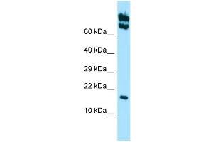 WB Suggested Anti-HSPB11 Antibody Titration: 1. (HSPB11 抗体  (Middle Region))