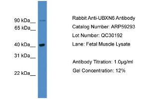 WB Suggested Anti-UBXN6  Antibody Titration: 0. (UBXN6 抗体  (C-Term))