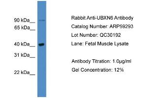 WB Suggested Anti-UBXN6  Antibody Titration: 0.