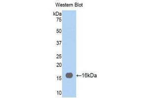 Western Blotting (WB) image for anti-Fascin (FSCN1) (AA 277-396) antibody (ABIN1858919) (Fascin 抗体  (AA 277-396))