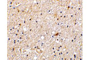 Immunohistochemistry (IHC) image for anti-Nerve Growth Factor Receptor (TNFRSF16) Associated Protein 1 (NGFRAP1) (Middle Region) antibody (ABIN1031007) (Nerve Growth Factor Receptor (TNFRSF16) Associated Protein 1 (NGFRAP1) (Middle Region) 抗体)