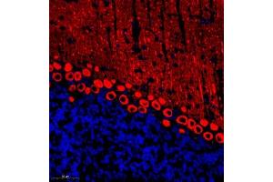 Immunofluorescent analysis of paraffin embedded mouse cerebellum using HOMER3 (ABIN7074257) at dilution of 1: 700 (HOMER3 抗体)