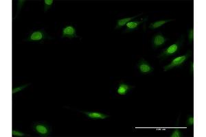 Immunofluorescence of monoclonal antibody to HNF4A on HeLa cell. (HNF4A 抗体  (AA 324-423))