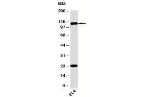 Western blot testing of mouse samples with TLR9 antibody at 2ug/ml. (TLR9 抗体  (N-Term))