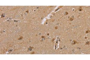Immunohistochemistry of paraffin-embedded Human brain tissue using DLD Polyclonal Antibody at dilution 1:35 (DLD 抗体)