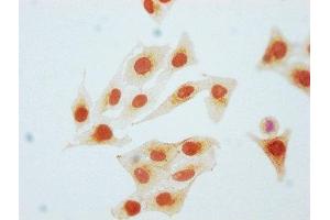 Immunocytochemistry analysis of ABIN7127684 diluted at 1:80 and staining in Hela cells(treated with Pervanadate) performed on a Leica BondTM system. (Recombinant CDK2 抗体  (pTyr15))