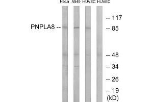Western Blotting (WB) image for anti-Patatin-Like phospholipase Domain Containing 8 (PNPLA8) (C-Term) antibody (ABIN1850962) (PNPLA8 抗体  (C-Term))