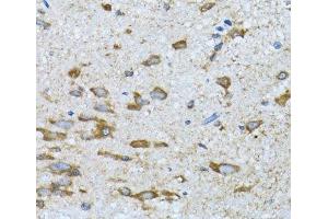 Immunohistochemistry of paraffin-embedded Mouse spinal cord using PDP1 Polyclonal Antibody at dilution of 1:100 (40x lens). (PDP 抗体)