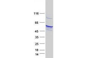 Western Blotting (WB) image for Tryptophan Hydroxylase 1 (TPH1) protein (Myc-DYKDDDDK Tag) (ABIN2734414)