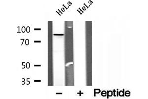 Western blot analysis of extracts of HeLa cells, using OSBP antibody. (OSBP 抗体  (Internal Region))