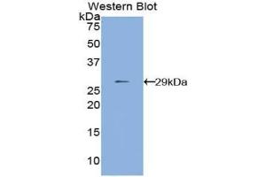 Detection of Recombinant MMP24, Human using Polyclonal Antibody to Matrix Metalloproteinase 24 (MMP24)