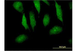 Immunofluorescence of monoclonal antibody to MTPN on HeLa cell. (MTPN 抗体  (AA 1-118))