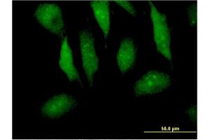 Immunofluorescence of monoclonal antibody to MTPN on HeLa cell. (MTPN 抗体  (AA 1-118))